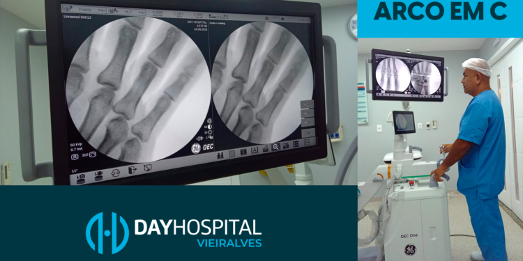 Nova Aquisição no Day Hospital Vieiralves Eleva o Padrão de Procedimentos Cirúrgicos