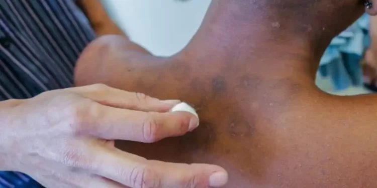 © SMS de Mesquita/RJ