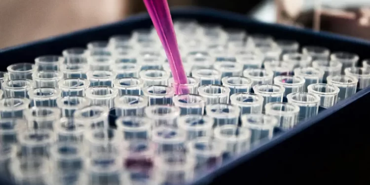 © Louis Reed/Unsplash